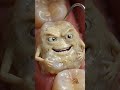 Dental Plaque – Dominant – Tooth Surface