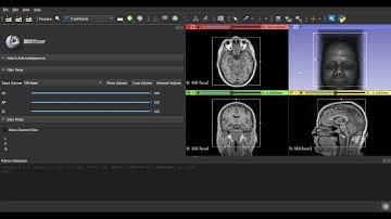 3D Slicer crop module V2