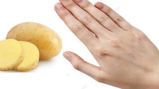 Hands Whitening Tips With Potato ! 100% Effective ! Skin Whitening at Home ! มือขาวจริง