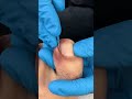 Satisfying nail cleaning process#nailcare #pedicure #satisfying #nailtech #oddlysatisfying #fyp