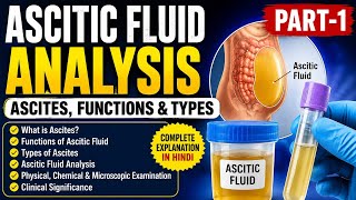 7Ascitic Fluid Kya Hota Hai? Analysis, Types & Functions | Medical Lab