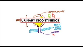 Urinary Incontinence  Stress, Urge, Overflow: Pathophysiology, Clinical correlation | USMLE | MCQs