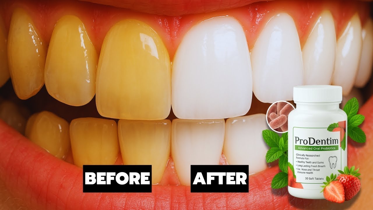 prodentim vs dentitox pro : Don’t Buy EITHER Until You See THIS! Prodentim vs Dentitox Pro