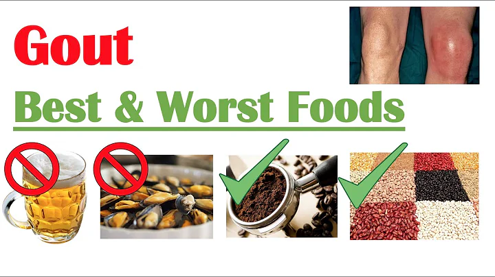 Best & Worst Foods to Eat with Gout | Reduce Risk of Gout Attacks and Hyperuricemia - DayDayNews