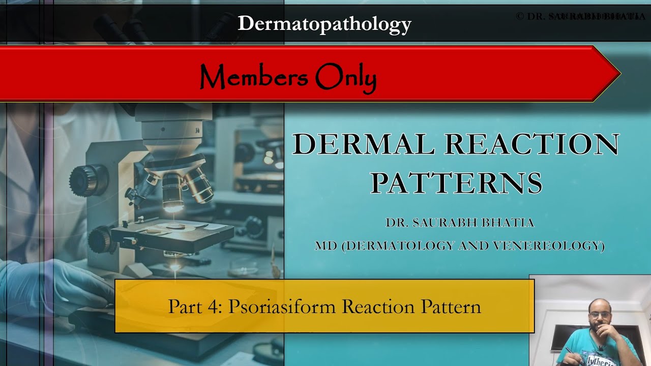 [Members Only] Dermatopathology - IV - Psoriasiform Tissue Reaction ...