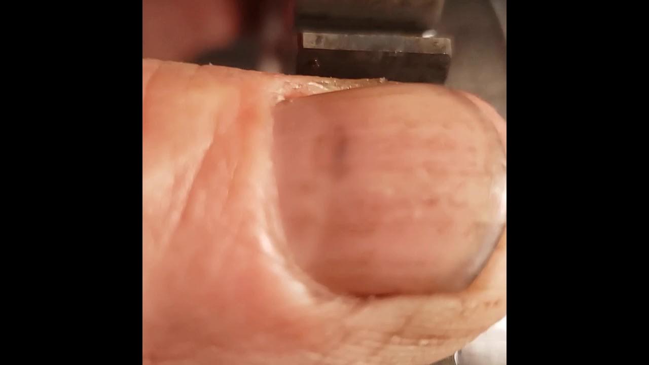 v star starter clutch