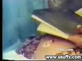 World's Biggest Zit!