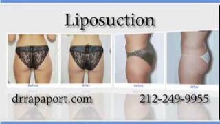Liposuction New York - Plastic Surgeon Manhattan - David Rapaport, MD, FACS
