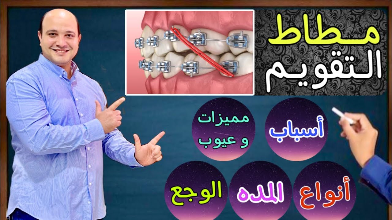 مطاط تقويم الاسنان | شرح وافي 