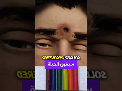 تم اطلق نار عليه قصص اكسبلور