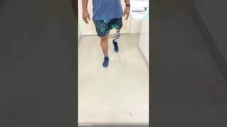 Ottobock 3R80 Knee and Össur Pro-Flex XC Foot