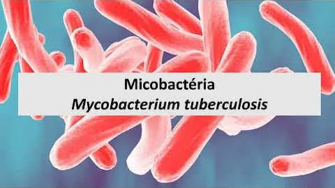 Como ocorre a formação do granuloma na tuberculose?