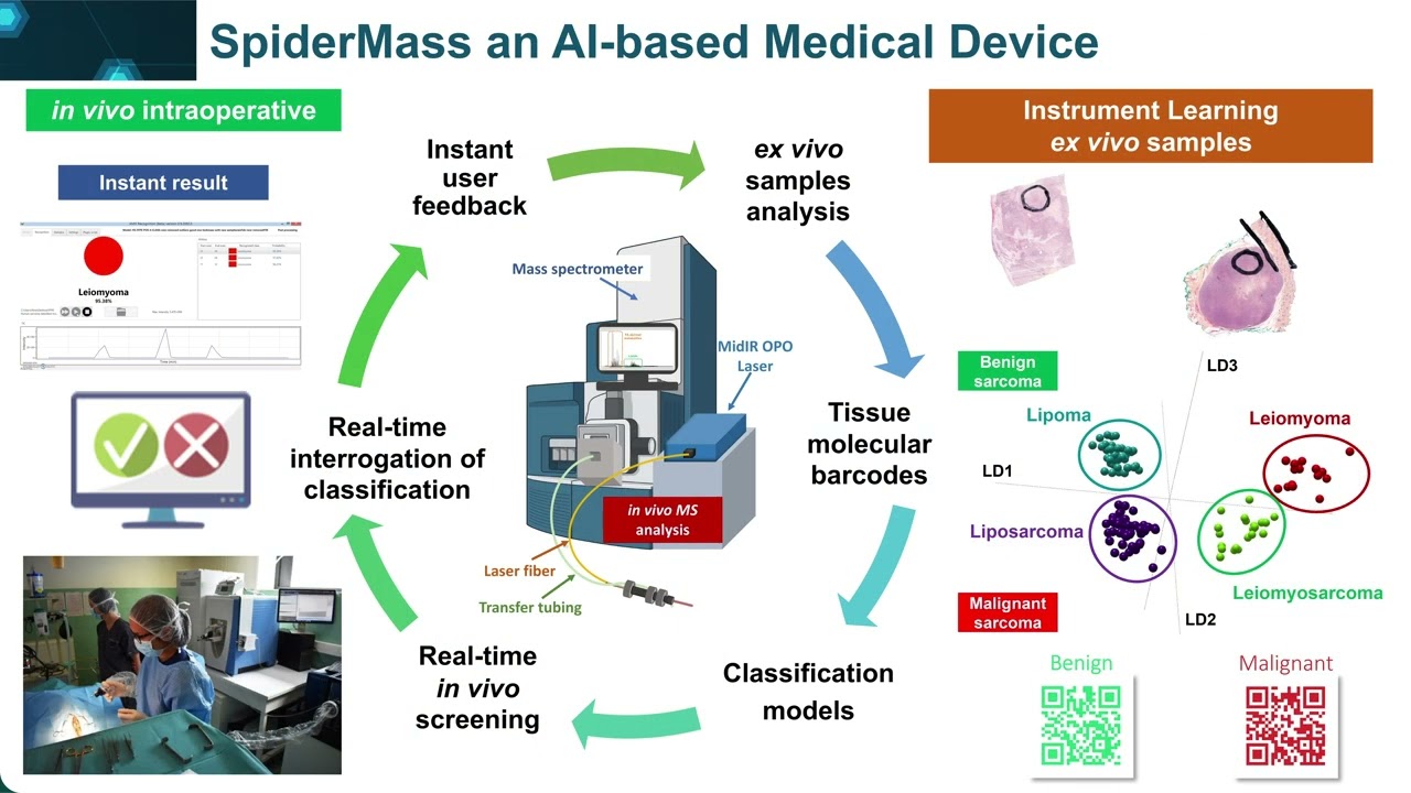 MESSIDORE | Sarcomes : une innovation pour améliorer la prise en charge des patients