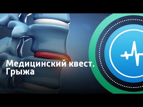 Медицинский квест. Грыжа | Телеканал «Доктор»