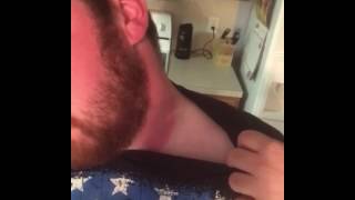 PSA: Wear Sunscreen