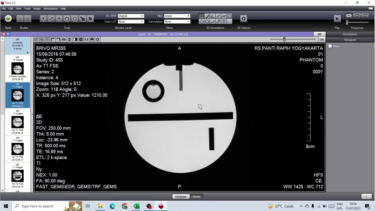 QA/QC MRI dengan phantom ACR dan Aplikasi Onis
