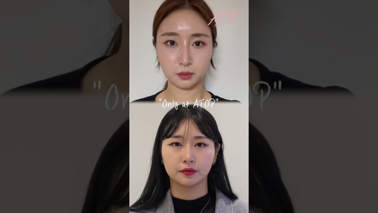 [에이탑 성형외과] 코 재수술 + 지방흡입 후기 #shorts ↑↑↑풀영상보기↑↑↑