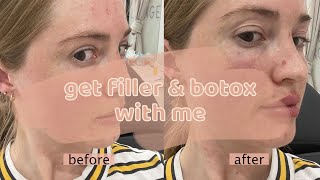 come get filler and botox with me