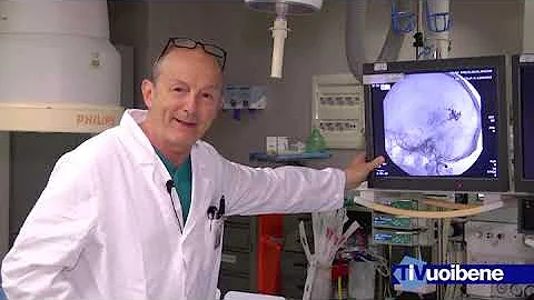 Che cos'è un angioma al cervello?