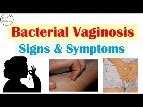 Bacterial Vaginosis Signs & Symptoms (things You’ve Never Heard Of!)