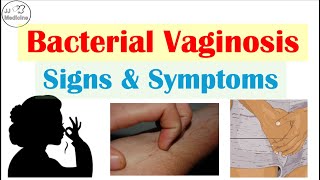 Bacterial Vaginosis Signs & Symptoms (Things You’ve Never Heard Of!)