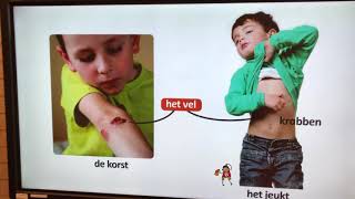 Hatsjoe Dag 3 Het Jeukt