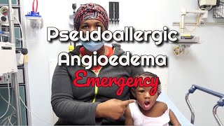 Pseudoallergic Angioedema Emergency