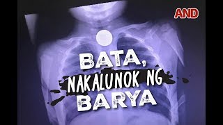 Bata, nakalunok ng barya