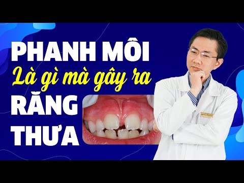Video Phanh Môi Là Gì? Mà Lại Gây Ra Tình Trạng Răng Thưa? - youtube
