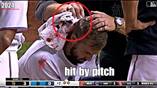 MLB• Worst Hit By Pitch 4th April 2024