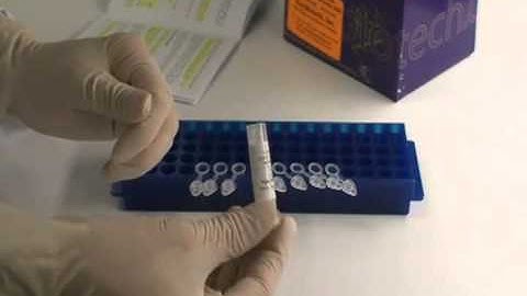 Multiplex Protein Detection with Quantibody Arrays