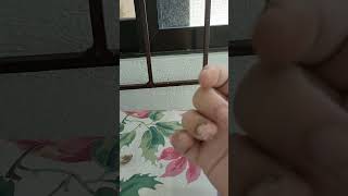 [Shorts] Recovery Update - Incomplete