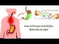 8 Ways to Prevent Acid Reflux Naturally At Night!