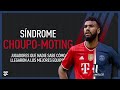 Síndrome: Eric Choupo-Moting. Jugadores que nadie sabe como llegaron a los mejores equipos