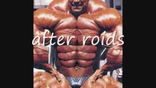 Barry Bonds Before and After Steroids