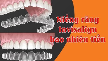 Niềng răng invisalign bao nhiêu tiền?
