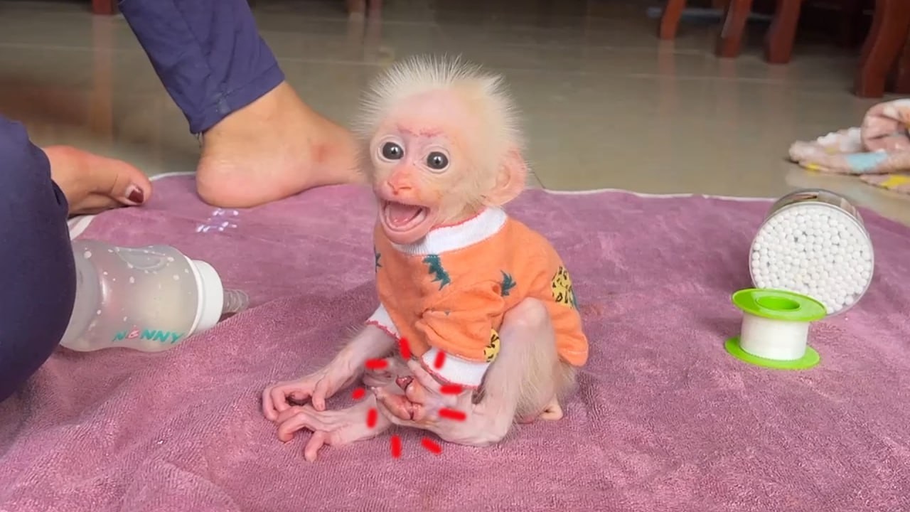 [Heart Breaking] Minea Screaming & Crying So Pityful Because She Hurt HerToe