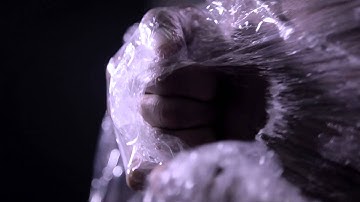 Hepatitis C - Face Up