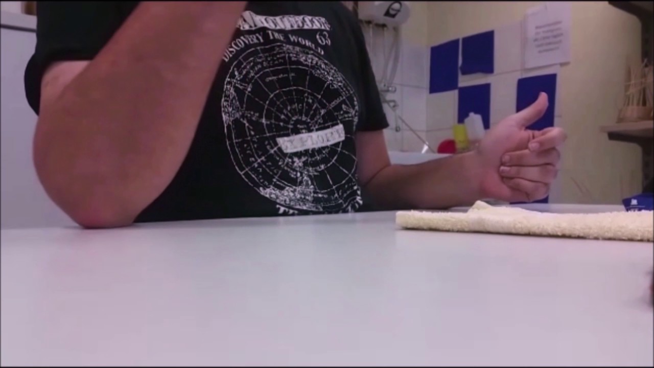 Halbseitenlähmung - Übungen 6 Monate nach der Hirnblutung