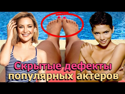 Скрытые дефекты внешности популярных актеров | Актеры с изюминкой