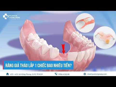 Video: Cách đeo răng giả