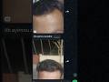 Customer Feedback. Planet Earth Organics. Hair and Beard Growth Spray #planetearthorganics #haircare