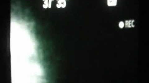 ITC Klaus Schreiber Method