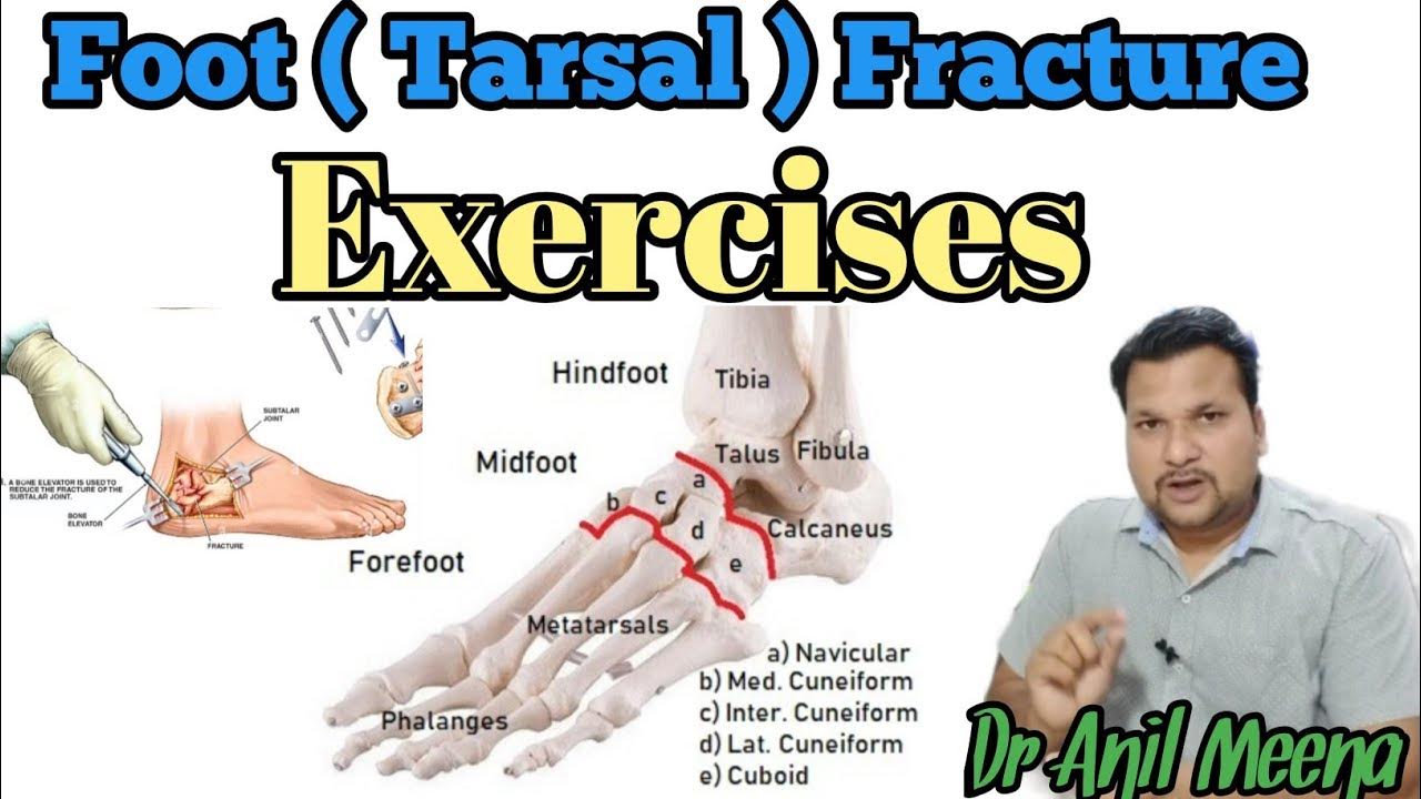 metatarsal bone fracture recovery exercises metatarsal fracture
