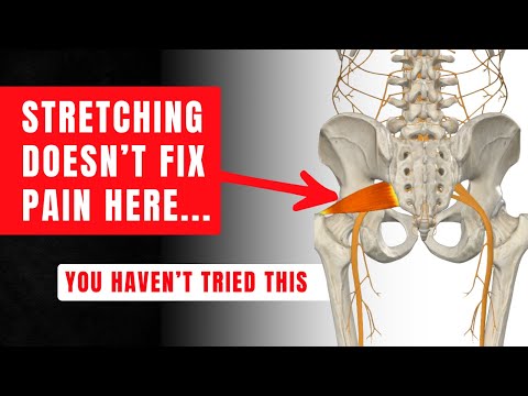 Don’t Stretch Your Tight Piriformis (do this instead)