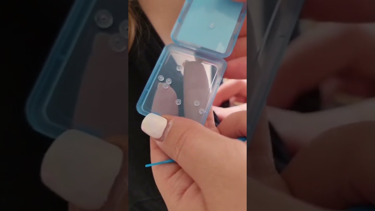 Skin Tag Remover Gets To Work In Days Before After TagBand Shorts