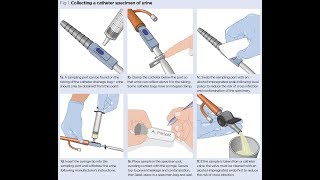 Osce for nmc part 2 exam videos. catheter urine sample collection
training must watch overseas nurses preparing test of competence...