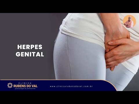 Herpes Genital Sintomas Tratamento E Prevencao Clinica Rubens