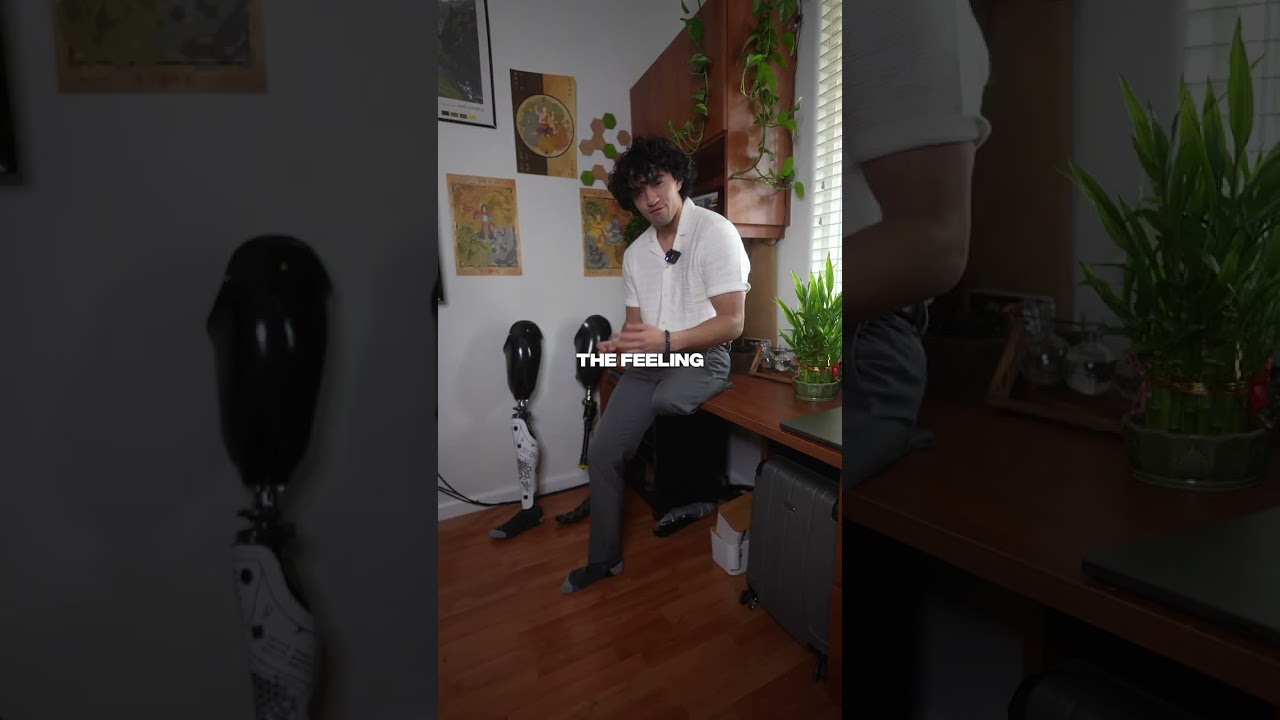 I can still FEEL my leg after its CUT OFF? Phantom Limb explained