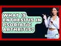 What Is Enthesitis In Psoriatic Arthritis? - Skin Savvy Dermatology